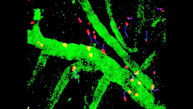 TPLSM image of 5xFAD mice showing migrating cells inside the brain parenchyma