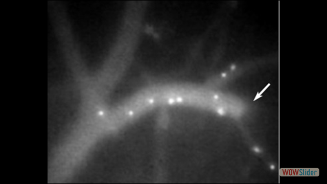 IVM image of Th1 cells after status epilepticus in cerebral vessels