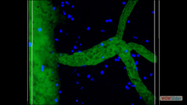 TPLSM image of EAE mice showing migrating cells inside the spinal cord parenchyma