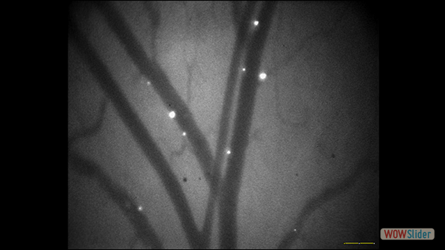 IVM image of Th1 cells interacting on thrombin activated mesenteric vessels