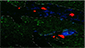 TPLSM image showing neutrophils labeled in red and migrating in the 5xFAD-YFPH mouse cortex. Abeta was labeled in blue. YFPH neurons are shown in green