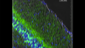 Confocal microscopy image of the somatosensory cortical portion used for TPLSM experiments. Cortex of a 5xFAD-YFPH mouse