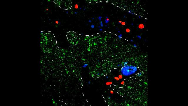 TPLSM image showing neutrophils labeled in red and migrating in the 5xFAD-YFPH mouse cortex. Abeta was labeled in blue. YFPH neurons are shown in green