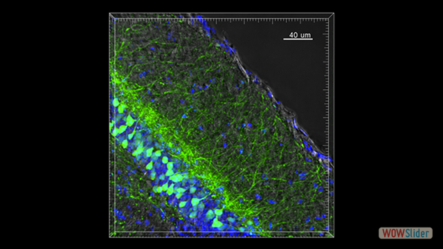 Confocal microscopy image of the somatosensory cortical portion used for TPLSM experiments. Cortex of a 5xFAD-YFPH mouse
