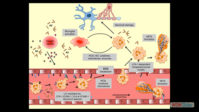 Graphical abstract showing: neutrophils induce Alzheimer’s disease-like pathology and cognitive decline via a mechanism dependent on LFA-1 integrin