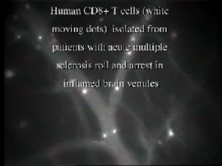 Brain microcirculation.mov